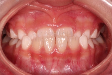 부산어린이교정