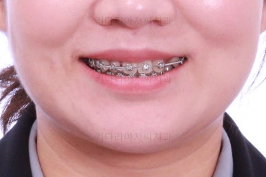 부산치아교정치과