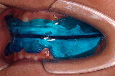 부산어린이교정