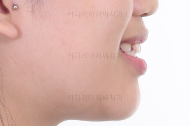 사직동교정치과