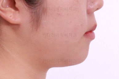부산교정전문치과