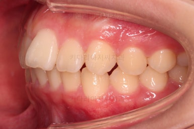 부산교정전문의