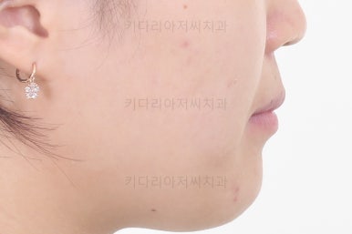 부산치아교정치과