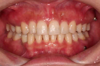 부산인비절라인