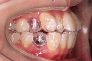 부산교정전문의