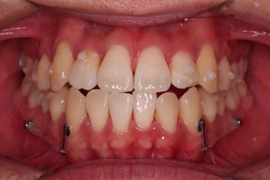 부산인비절라인