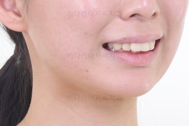 부산무턱교정치과