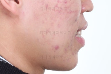 부산교정과전문의