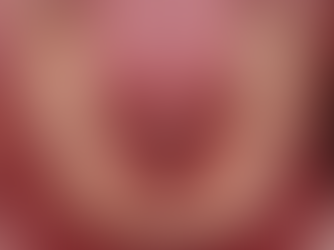 부산보철잘하는곳