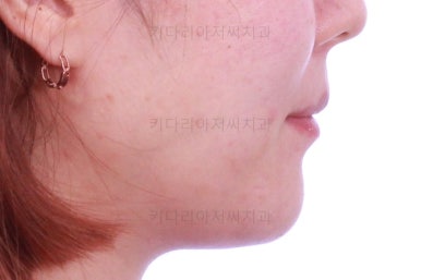 연산동교정치과