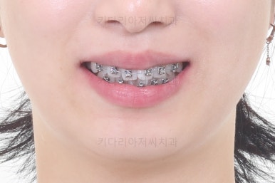 부산연산동부분교정