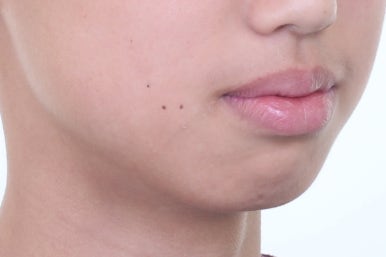 부산치아교정전문의