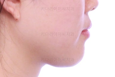 부산인비절라인