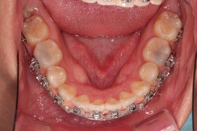 연산동치아교정치과