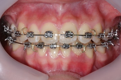 부산교정전문의