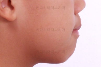 부산어린이교정