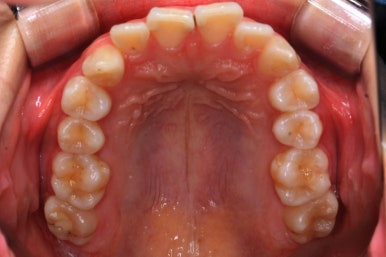 연산동교정치과
