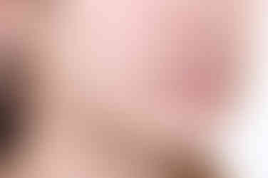 부산안면비대칭