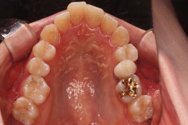 부산비대칭교정