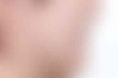 부산안면비대칭