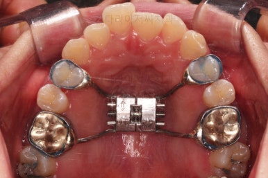 부산안면비대칭