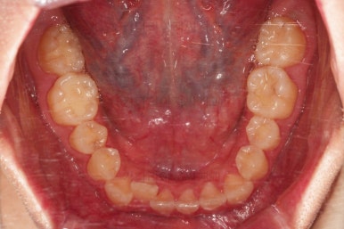 부산치아교정치과