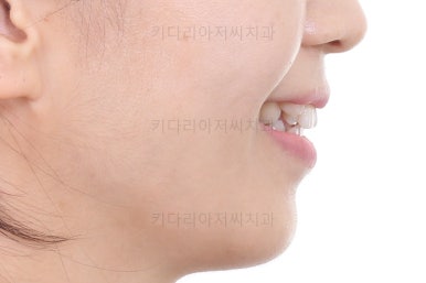 부산인비절라인