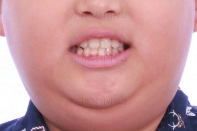 부산어린이교정