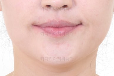 연산동교정치과