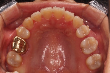 부산인비절라인