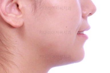 부산교정잘하는치과