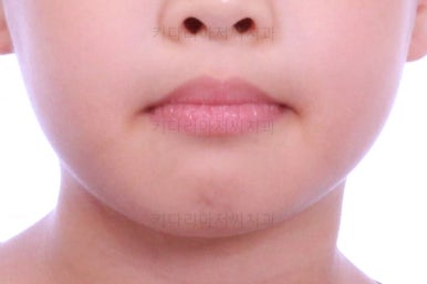 부산어린이교정