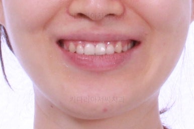 부산교정치과