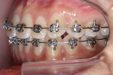 부산연산동청소년교정