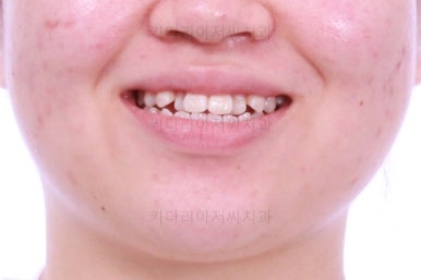 부산치아교정치과