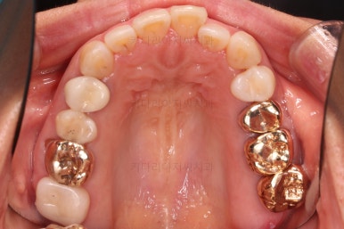 연산동부분교정