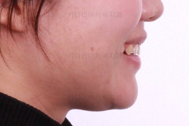 부산치아교정치과