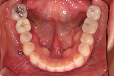 연산동부분교정