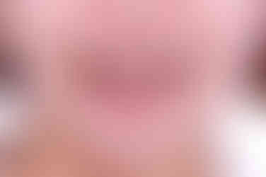 부산연산동교정치과