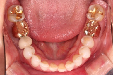 연산동부분교정