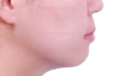 부산연산동치과