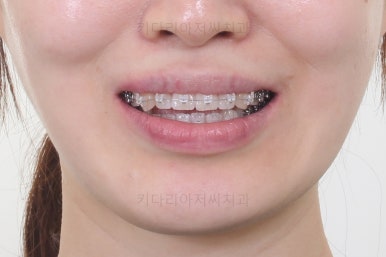 부산교정치과