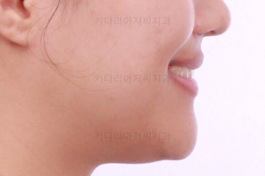 연산동치아교정치과