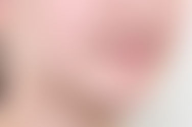 부산덧니교정