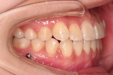 연산동교정치과