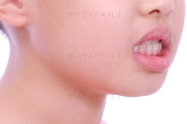 부산어린이교정