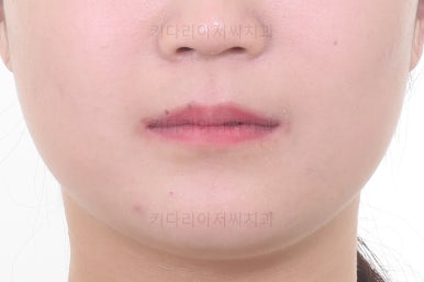 부산치아교정치과