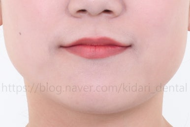 부산인비절라인
