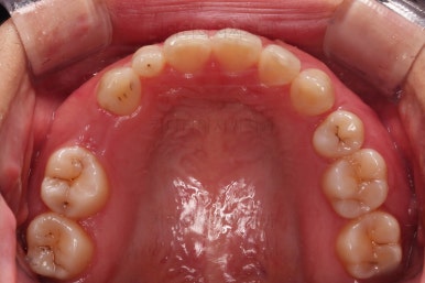 부산인비절라인