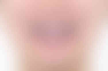 부산치아교정치과